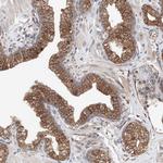 DNAH8 Antibody in Immunohistochemistry (Paraffin) (IHC (P))