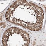 DNAH8 Antibody in Immunohistochemistry (Paraffin) (IHC (P))