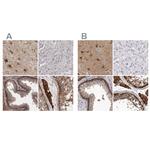 ENAH Antibody in Immunohistochemistry (IHC)