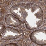 ENAH Antibody in Immunohistochemistry (IHC)