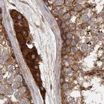 ENAH Antibody in Immunohistochemistry (IHC)