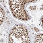 HENMT1 Antibody in Immunohistochemistry (IHC)