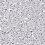 EXOSC10 Antibody in Immunohistochemistry (Paraffin) (IHC (P))