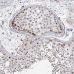 EXOSC10 Antibody in Immunohistochemistry (Paraffin) (IHC (P))