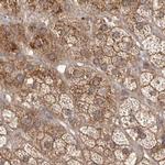 NUP43 Antibody in Immunohistochemistry (IHC)