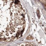 NUP43 Antibody in Immunohistochemistry (IHC)