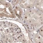 NUP43 Antibody in Immunohistochemistry (IHC)