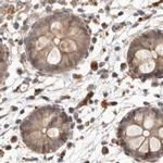 NUP43 Antibody in Immunohistochemistry (IHC)