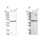 NUP43 Antibody in Western Blot (WB)