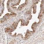 UBXN10 Antibody in Immunohistochemistry (Paraffin) (IHC (P))