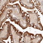 UBXD5 Antibody in Immunohistochemistry (IHC)