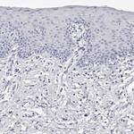 INSL3 Antibody in Immunohistochemistry (Paraffin) (IHC (P))