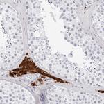 INSL3 Antibody in Immunohistochemistry (IHC)