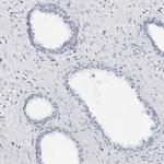 WDR65 Antibody in Immunohistochemistry (Paraffin) (IHC (P))