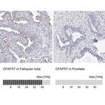 WDR65 Antibody in Immunohistochemistry (IHC)