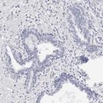 WDR65 Antibody in Immunohistochemistry (IHC)