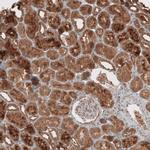 RAB11FIP3 Antibody in Immunohistochemistry (IHC)