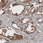 RAB11FIP3 Antibody in Immunohistochemistry (IHC)