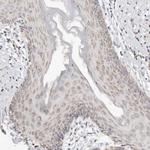 KDF1 Antibody in Immunohistochemistry (Paraffin) (IHC (P))