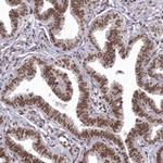 C1orf77 Antibody in Immunohistochemistry (Paraffin) (IHC (P))