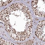 C1orf77 Antibody in Immunohistochemistry (Paraffin) (IHC (P))