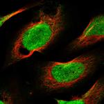 CHD1L Antibody in Immunocytochemistry (ICC/IF)