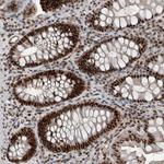 CHD1L Antibody in Immunohistochemistry (Paraffin) (IHC (P))