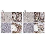 CHD1L Antibody in Immunohistochemistry (IHC)