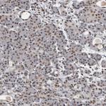 CHD1L Antibody in Immunohistochemistry (IHC)