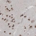 CHD1L Antibody in Immunohistochemistry (IHC)