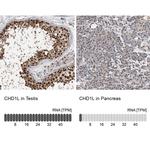 CHD1L Antibody