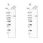 CHD1L Antibody in Western Blot (WB)