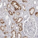 ESPN Antibody in Immunohistochemistry (Paraffin) (IHC (P))