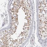 ESPN Antibody in Immunohistochemistry (Paraffin) (IHC (P))