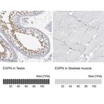 ESPN Antibody in Immunohistochemistry (IHC)