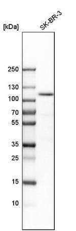 ESPN Antibody in Western Blot (WB)