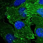 ENAH Antibody in Immunocytochemistry (ICC/IF)