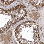 ENAH Antibody in Immunohistochemistry (Paraffin) (IHC (P))