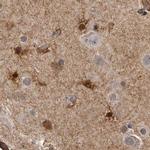 ENAH Antibody in Immunohistochemistry (IHC)