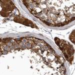 ENAH Antibody in Immunohistochemistry (IHC)