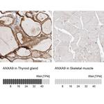 Annexin A9 Antibody in Immunohistochemistry (IHC)