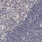 Annexin A9 Antibody in Immunohistochemistry (IHC)