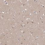 PFDN2 Antibody in Immunohistochemistry (Paraffin) (IHC (P))