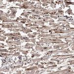 PFDN2 Antibody in Immunohistochemistry (Paraffin) (IHC (P))