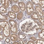 PFDN2 Antibody in Immunohistochemistry (Paraffin) (IHC (P))