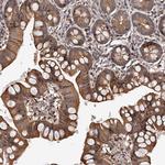 PFDN2 Antibody in Immunohistochemistry (Paraffin) (IHC (P))