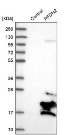 PFDN2 Antibody in Western Blot (WB)