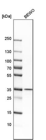 MOSC1 Antibody in Western Blot (WB)