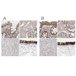 UFC1 Antibody in Immunohistochemistry (IHC)