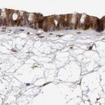 UFC1 Antibody in Immunohistochemistry (IHC)